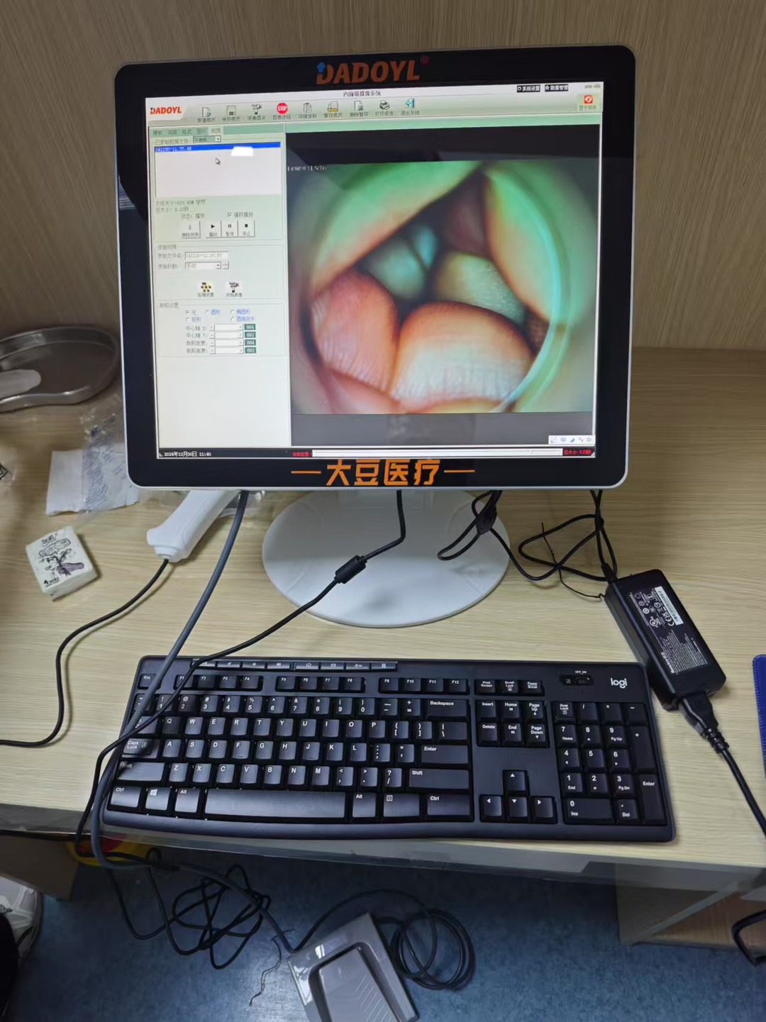 【大豆医疗】云南省某医院便携式电子肛门镜DD-100型装机培训